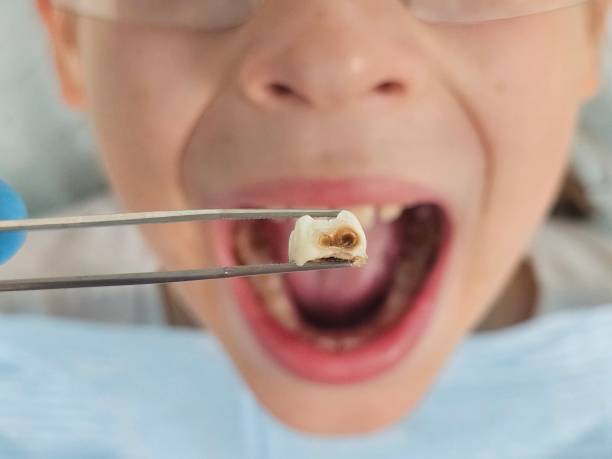 Best Orthodontic Emergency Dentist in Dwight, IL